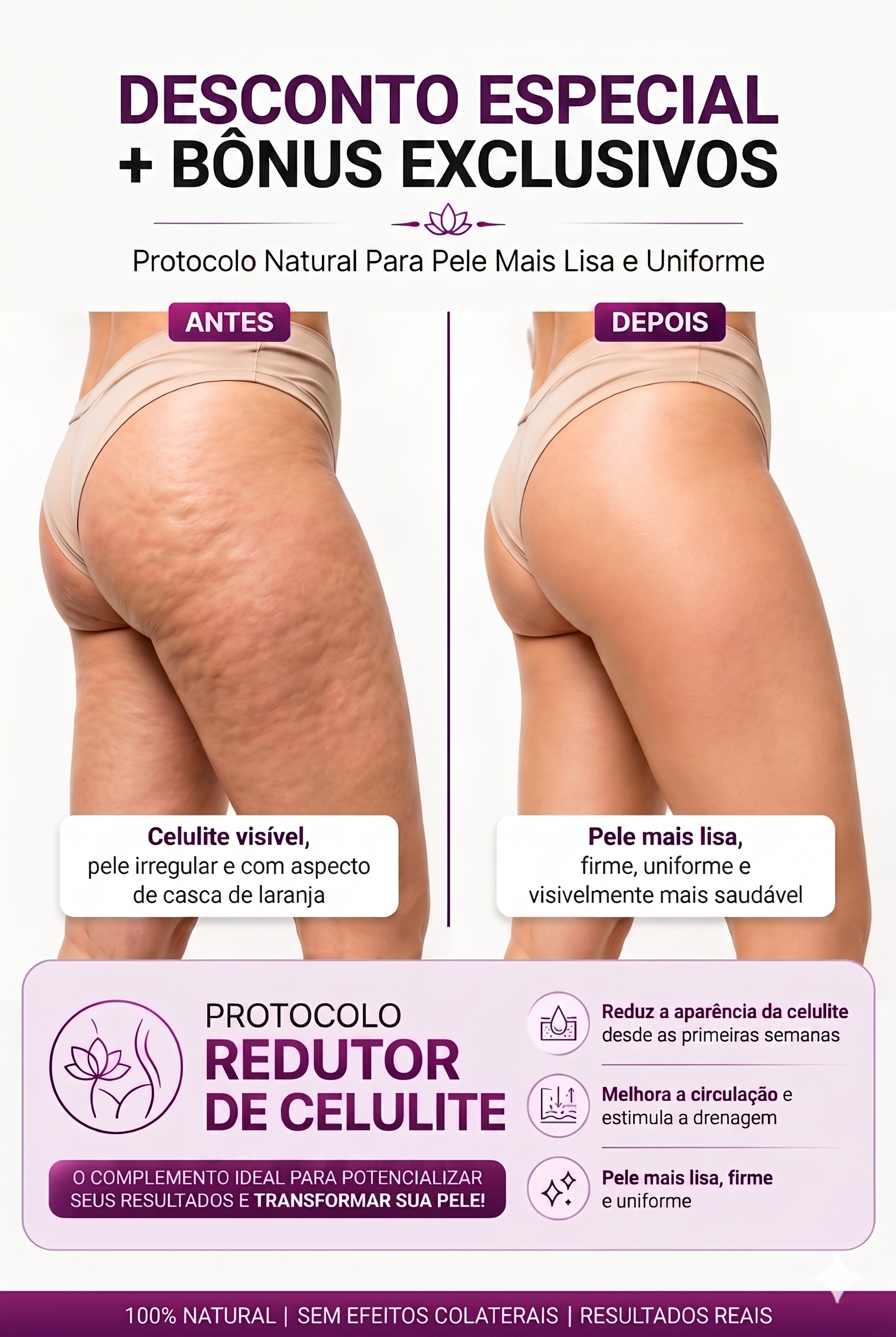 Antes e Depois da Celulite